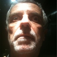 C. Alberto Augusto