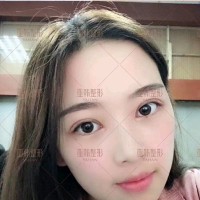 刘枫玲