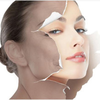 Collagen gold chống lão hóa