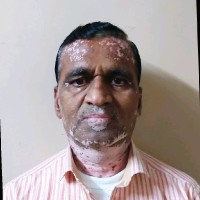 SANTOSH KHADE