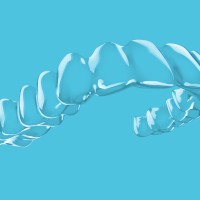 Spark Clear Aligners Uk Ireland