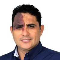 Denis Alexandre Marques