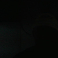 Benson Meso